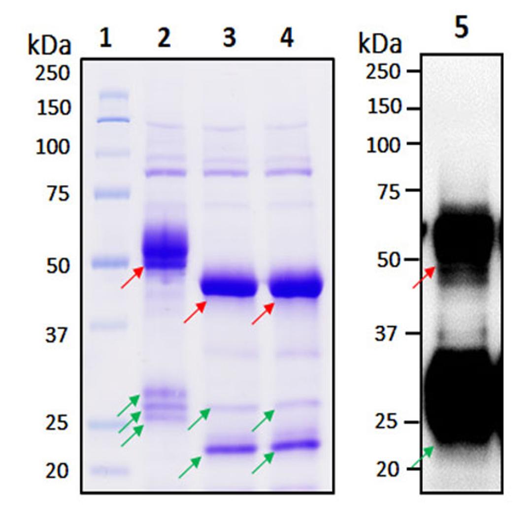 Recombinant SARS-CoV-2 Nucleocapsid Protein - RayBiotech Inc. - Life Sciences