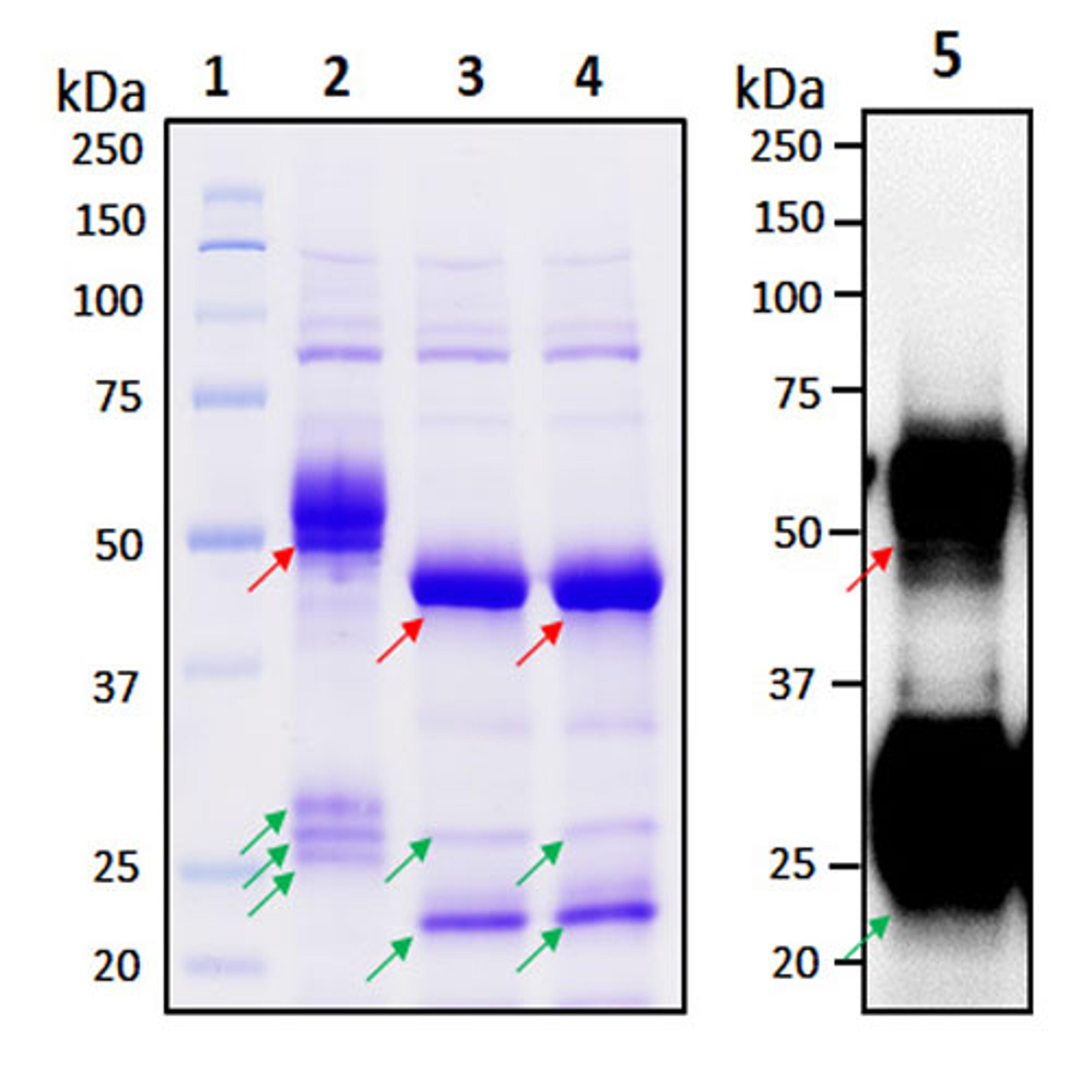 Recombinant SARS-CoV-2 Nucleocapsid Protein - RayBiotech Inc. - Life Sciences