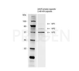 AAV5 empty capsids - PROGEN - Life Sciences