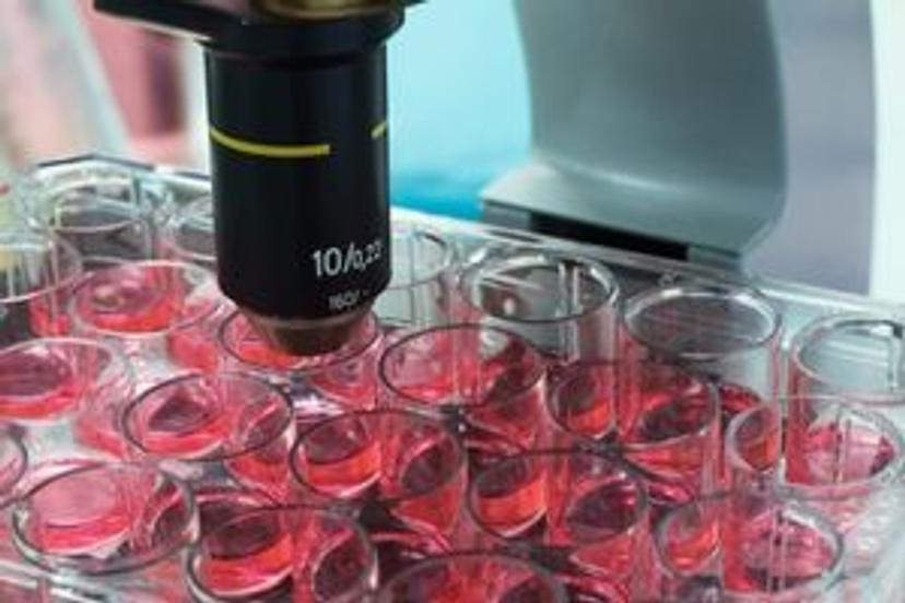 Capturing complexities of cell biology: Pushing the boundaries of imaging assays