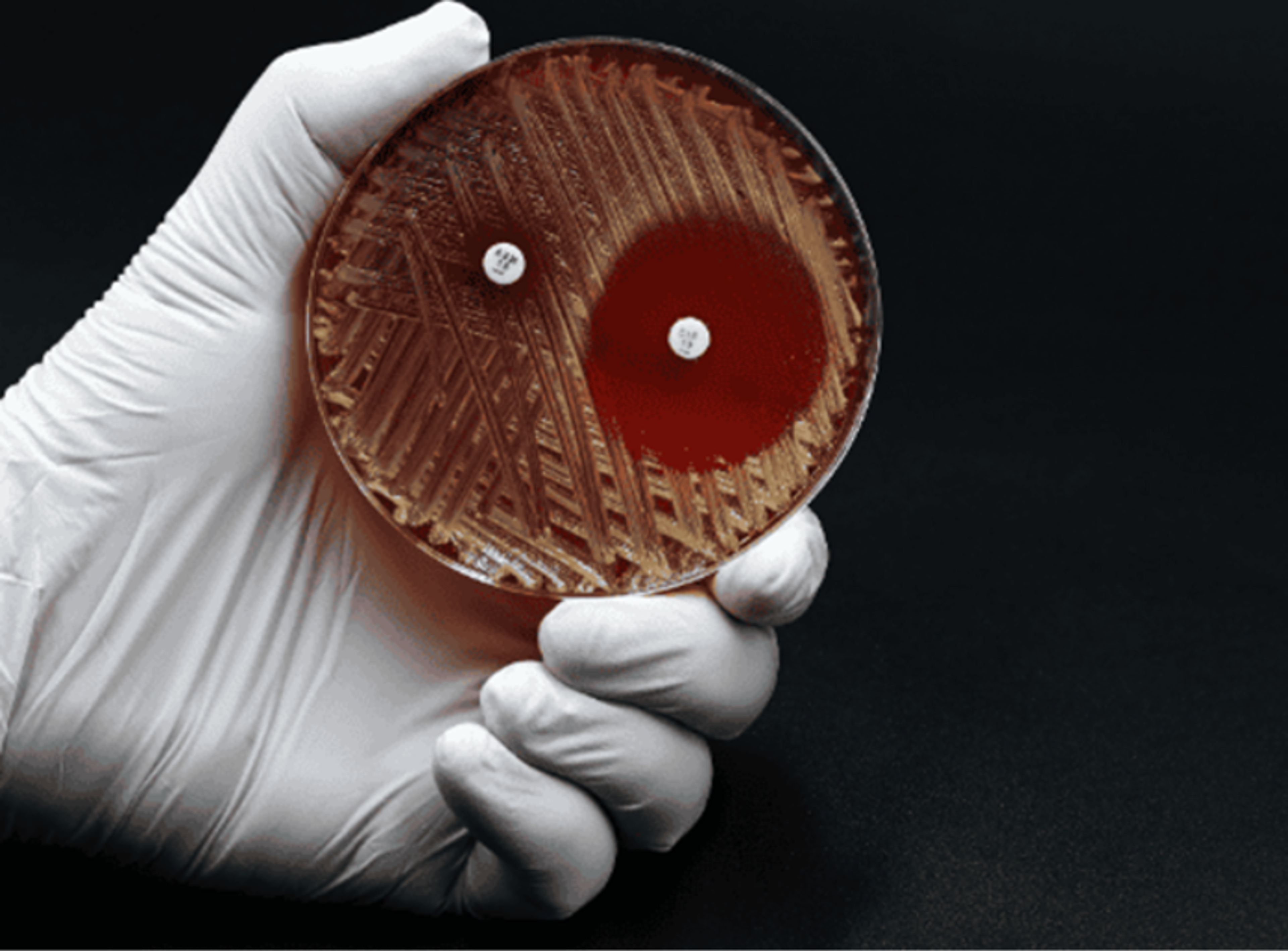 Antimicrobial resistance and the MRSA crisis