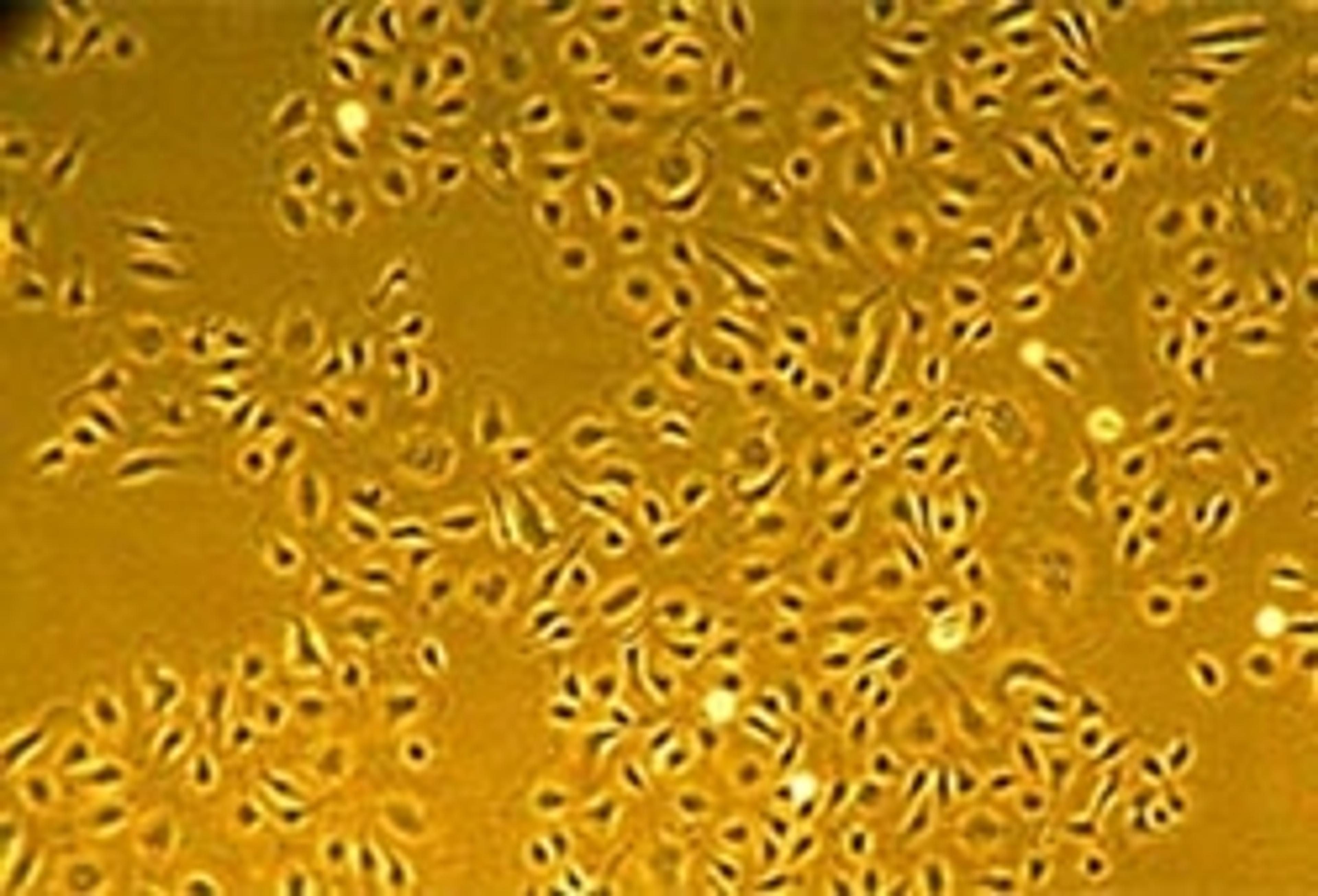 Normal -(HUVEC) Human Umbilical Vein Endothelial Cells - Lonza Group Ltd - Life Sciences