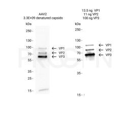 AAV2 VP1 + VP2 + VP3, recombinant proteins, set - PROGEN - Life Sciences