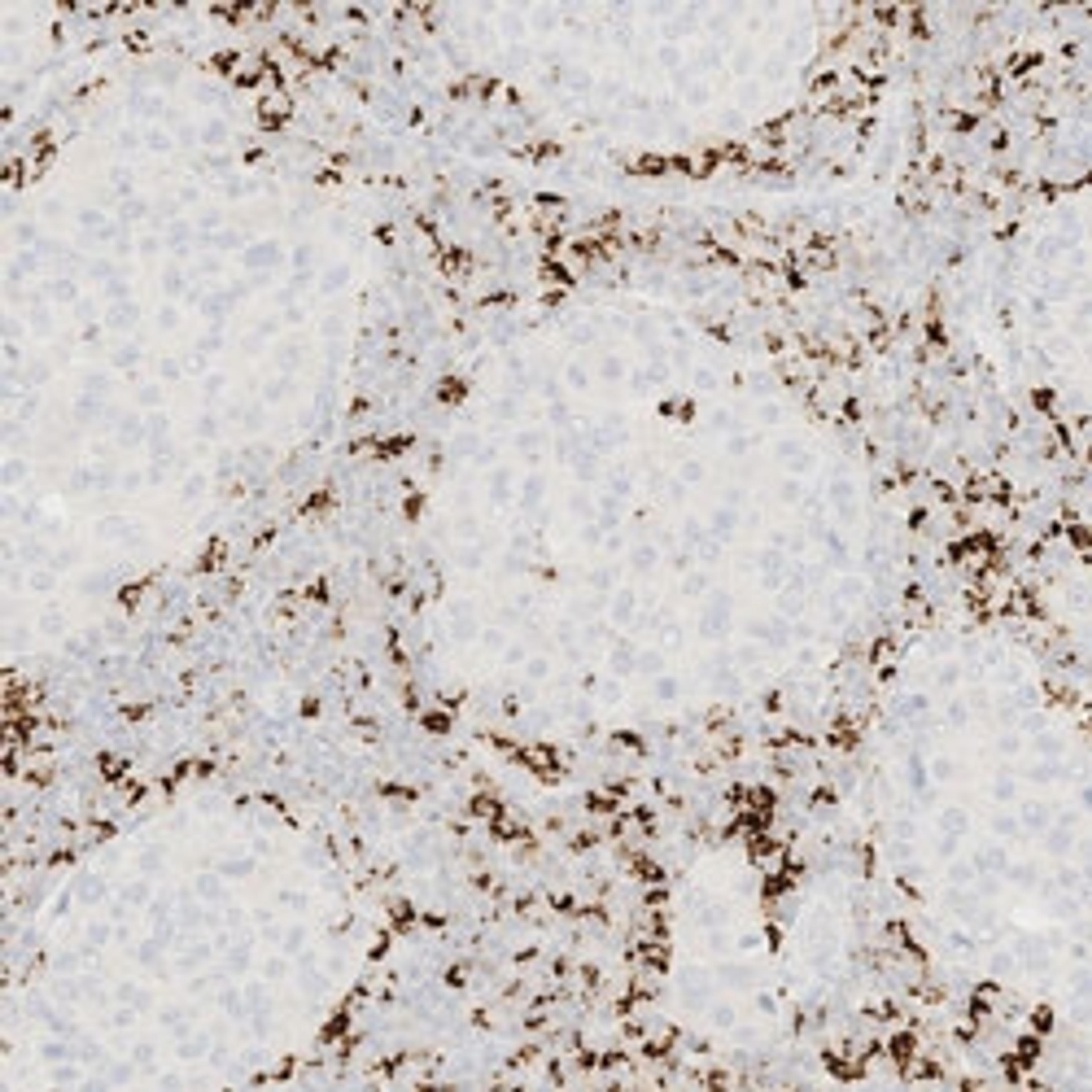 VENTANA PD-L1 (SP142) Assay (CE IVD)