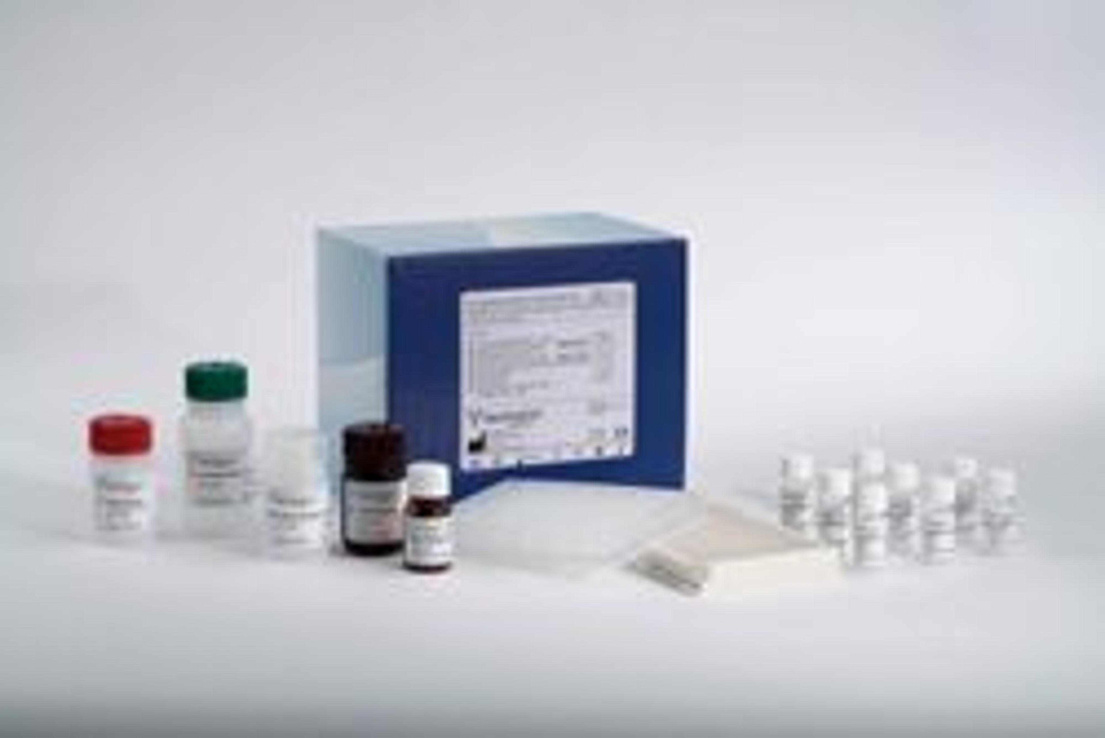 Gc-globulin (Actin Free) ELISA Kit - BioPorto Diagnostics A/S - Life Sciences