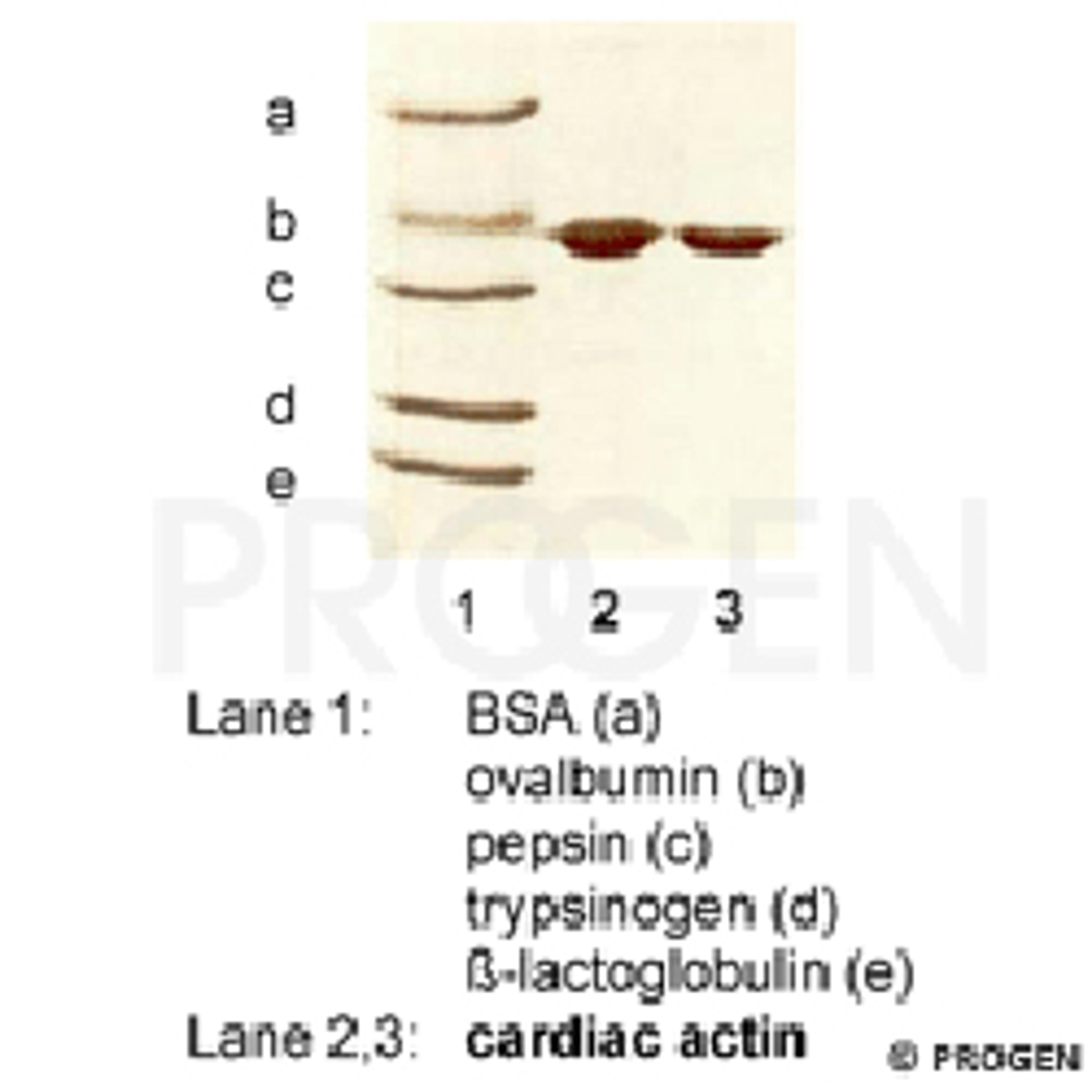 Cardiac Actin, bovine, 100 µg - PROGEN