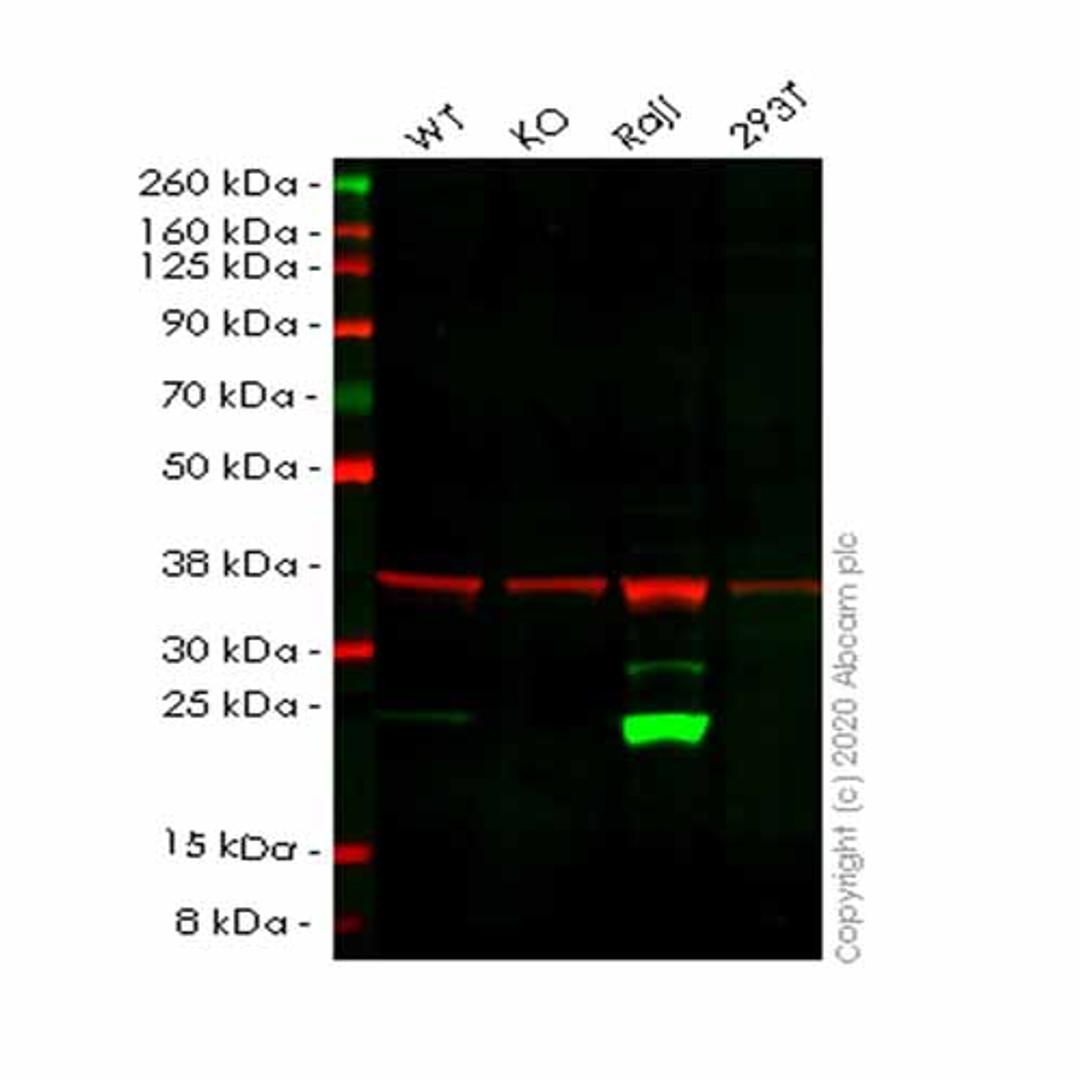 Human PSMB8 (Proteasome 20S LMP7) knockout A549 cell line - Abcam plc - Life Sciences