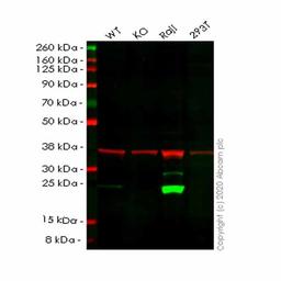 Human PSMB8 (Proteasome 20S LMP7) knockout A549 cell line - Abcam plc - Life Sciences