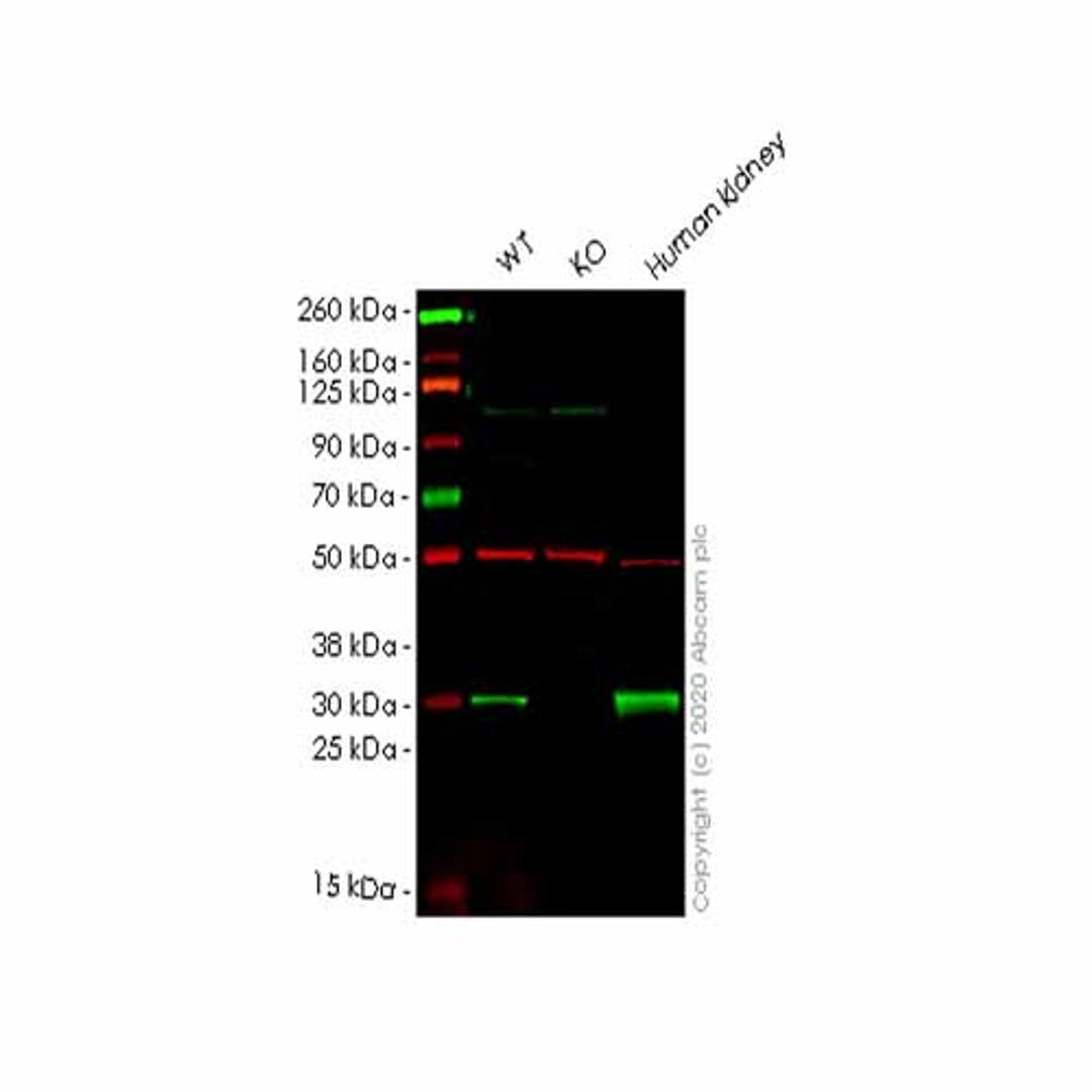 Human KHK (ketohexokinase) knockout HEK293T cell line - Abcam plc - Life Sciences