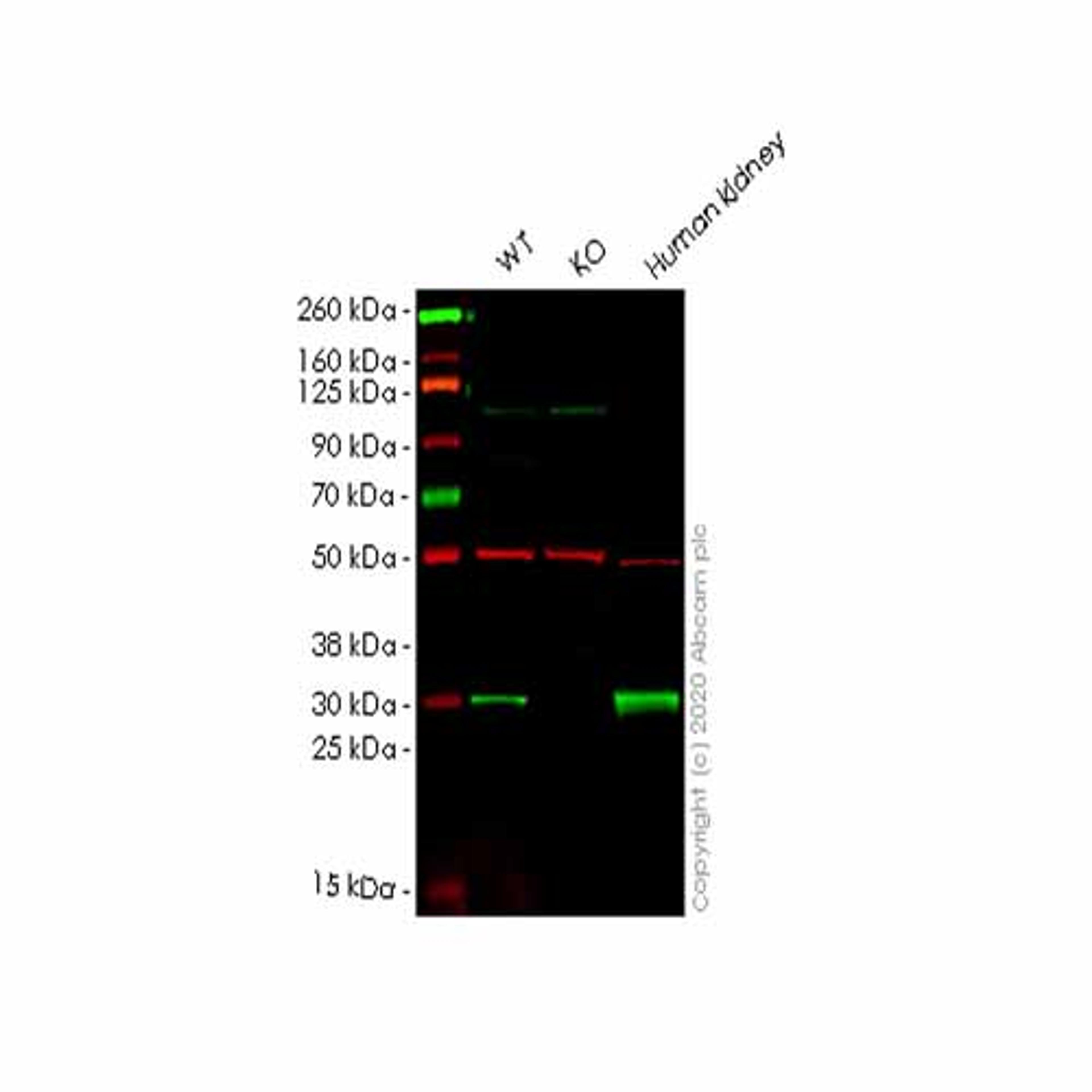 Human KHK (ketohexokinase) knockout HEK293T cell line - Abcam plc - Life Sciences