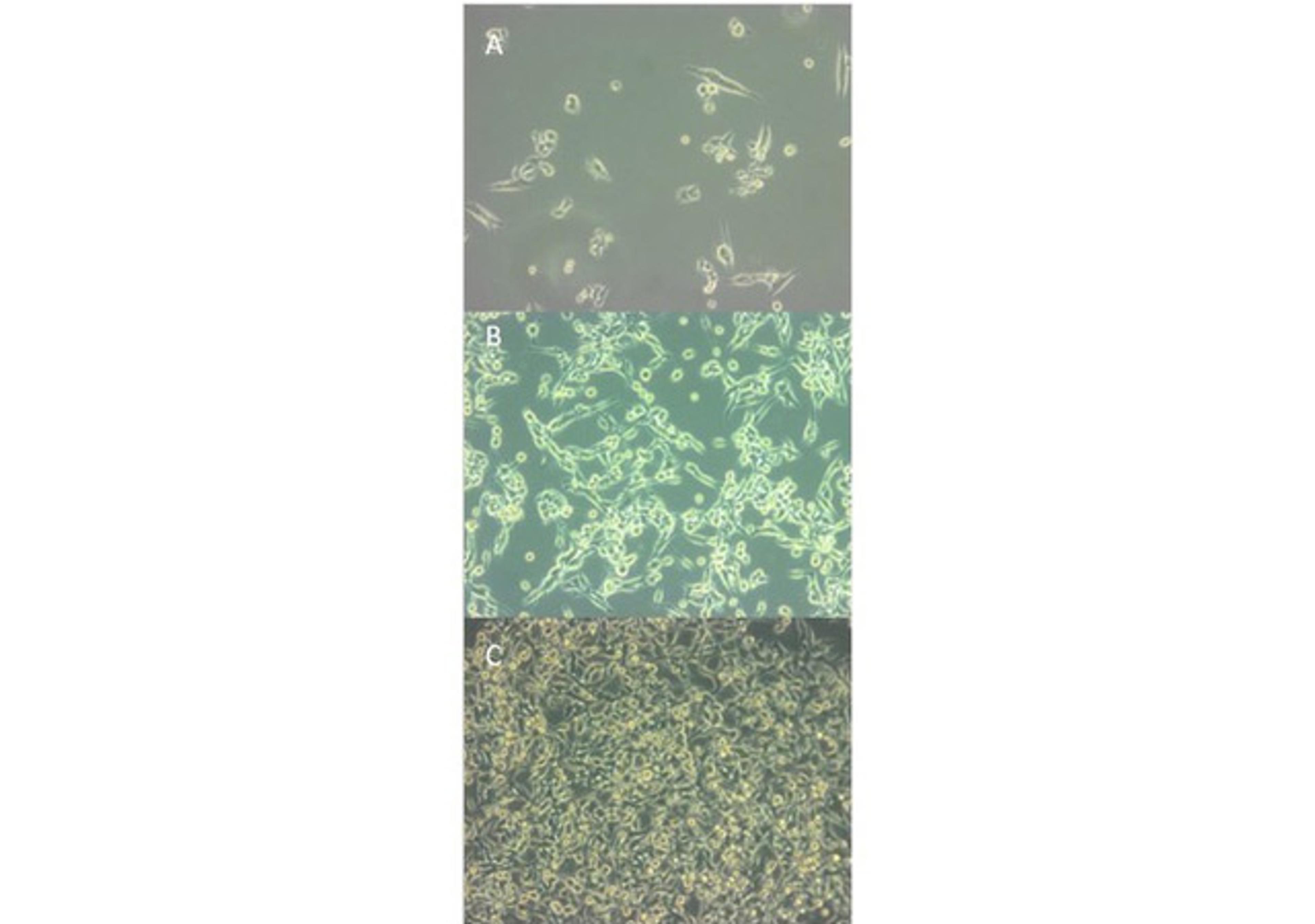 MB49 Murine Bladder Carcinoma Cell Line - Cancer Tools - Life Sciences