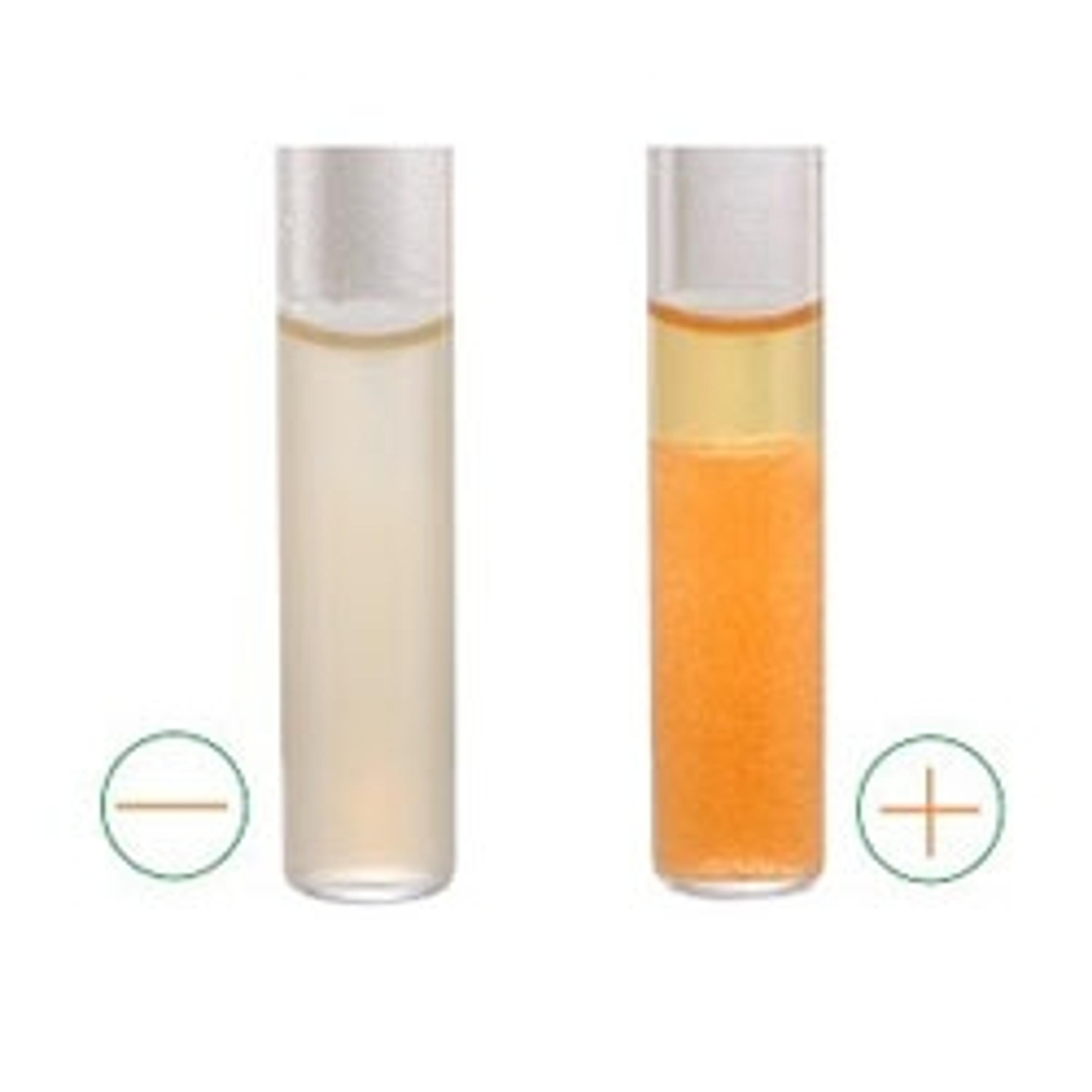 Strep B Carrot Broth™ One-Step - Hardy Diagnostics - Life Sciences