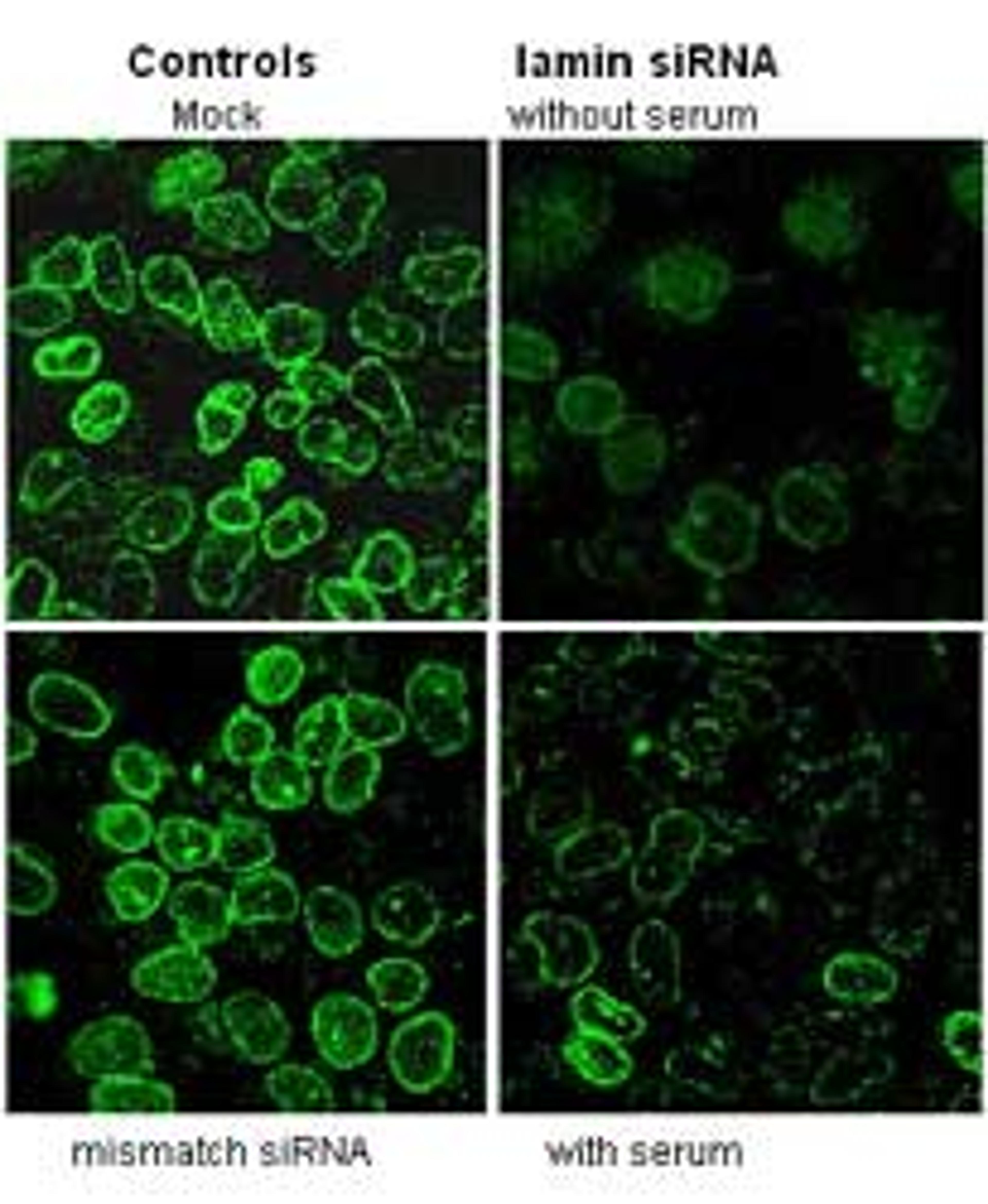 jetPEI™ the powerful transfection reagent - Polyplus Transfection