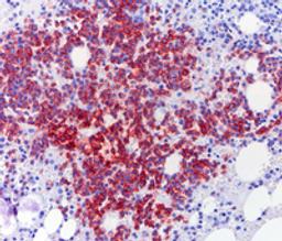 OSTEOSOFT® - Merck KGaA, Darmstadt, Germany - Clinical Diagnostics