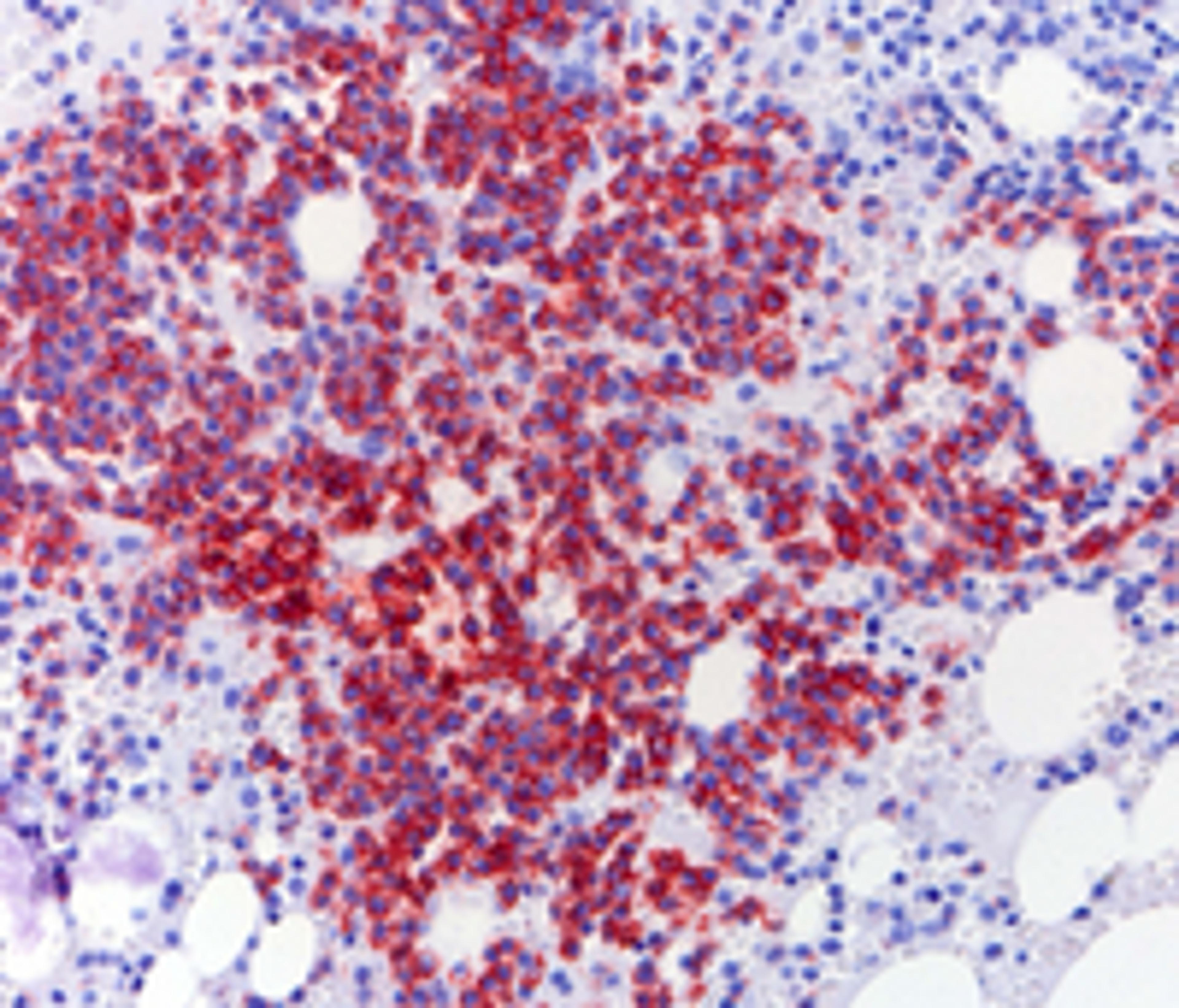 OSTEOSOFT® - Merck KGaA, Darmstadt, Germany - Clinical Diagnostics