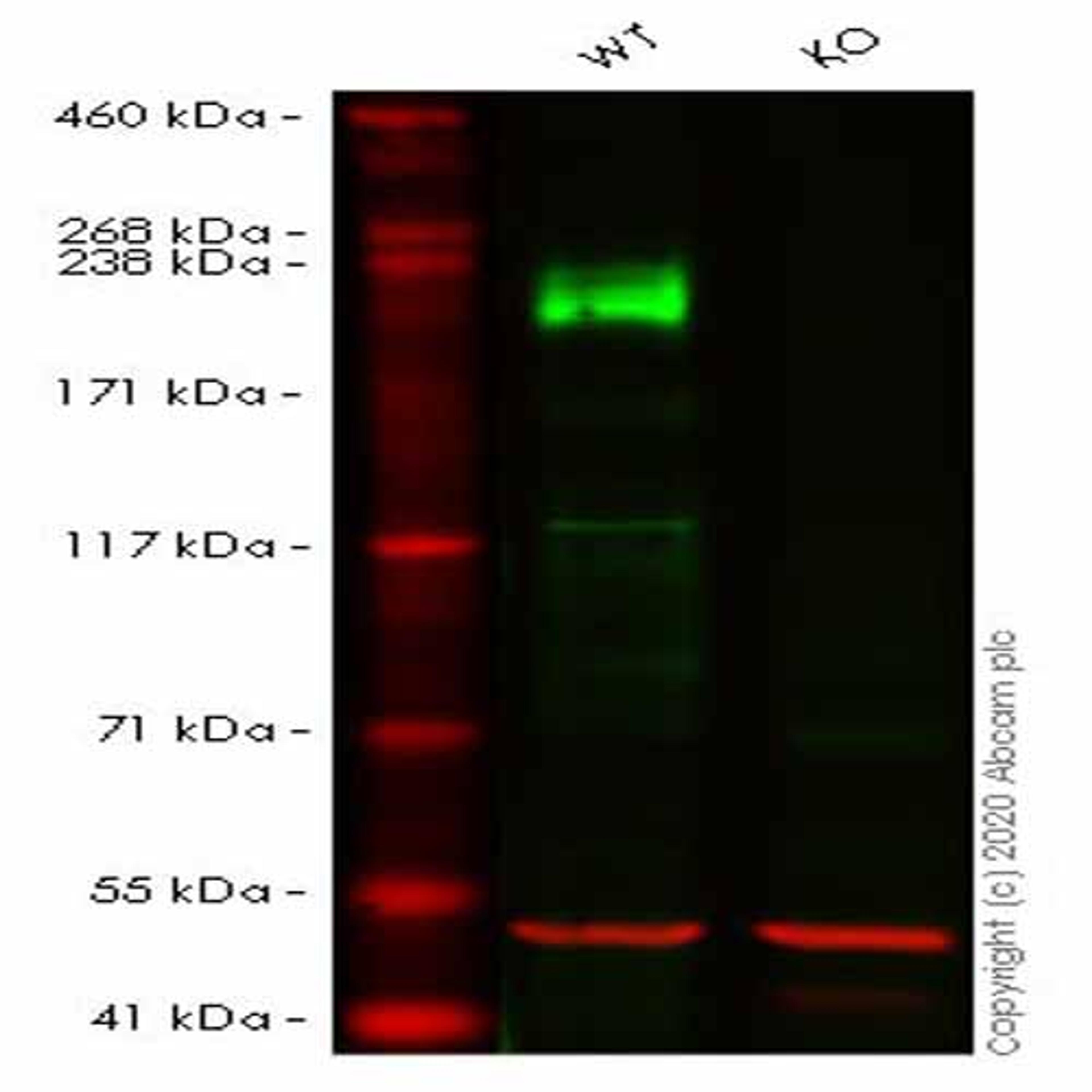Human LAMB1 (Laminin beta 1) knockout HeLa cell line - Abcam plc - Life Sciences
