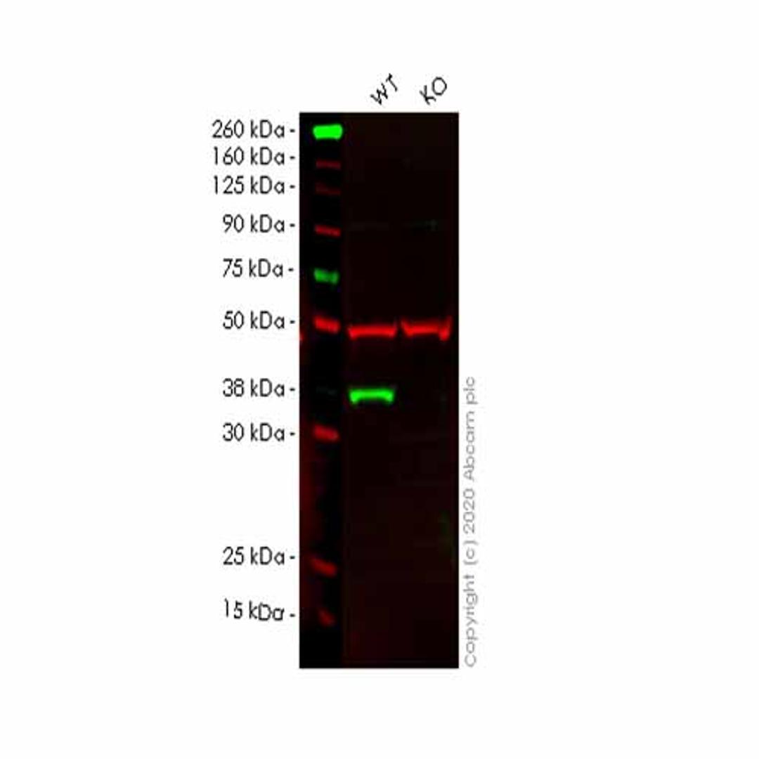 Human PTGR1 knockout HeLa cell line - Abcam plc - Life Sciences
