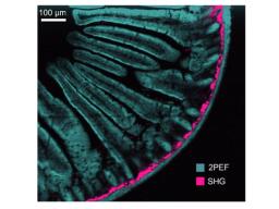 Multimodal Techniques   