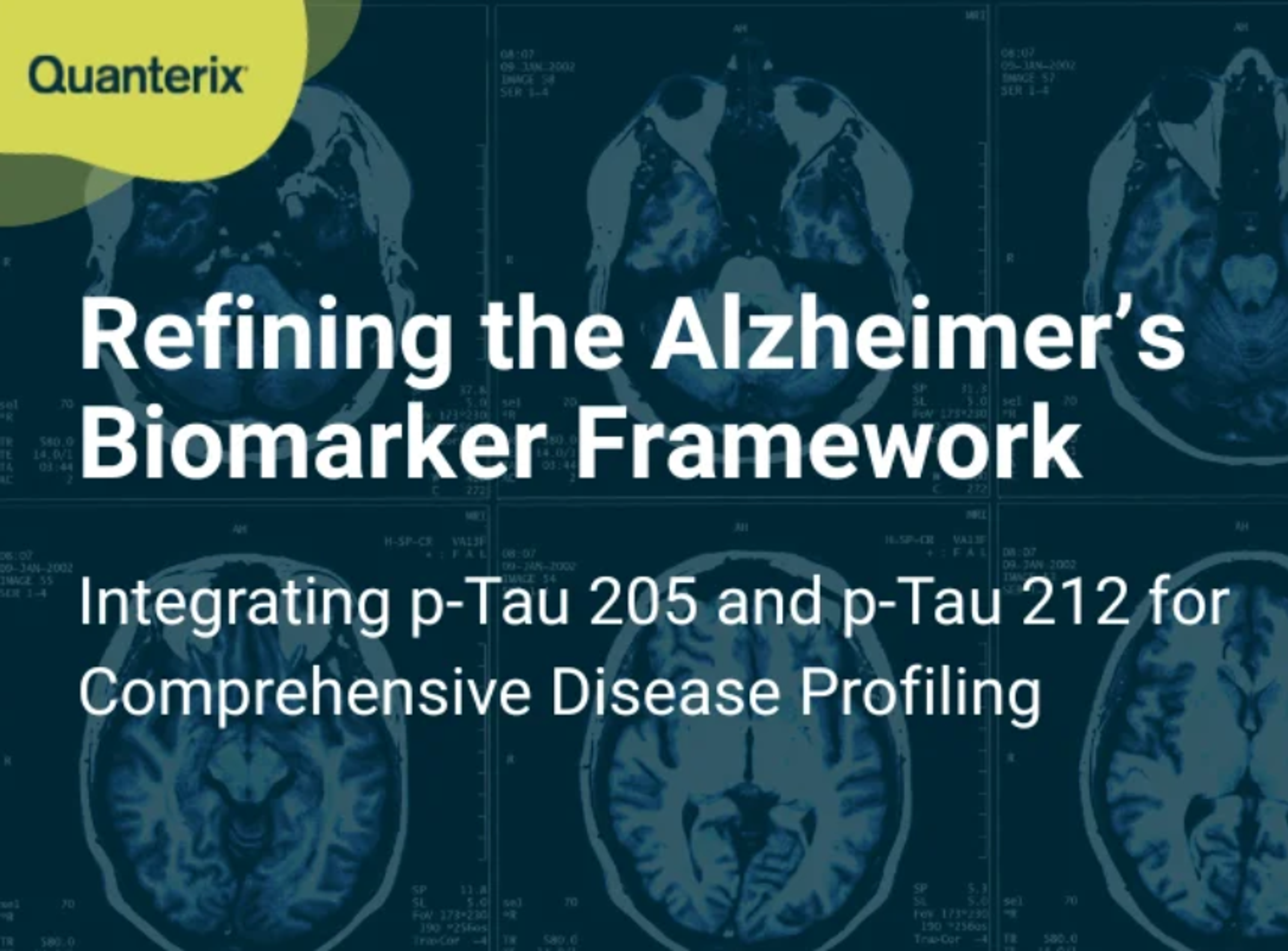 Quanterix launches novel p-Tau 205 and p-Tau 212 assays to advance Alzheimer’s research at AAIC