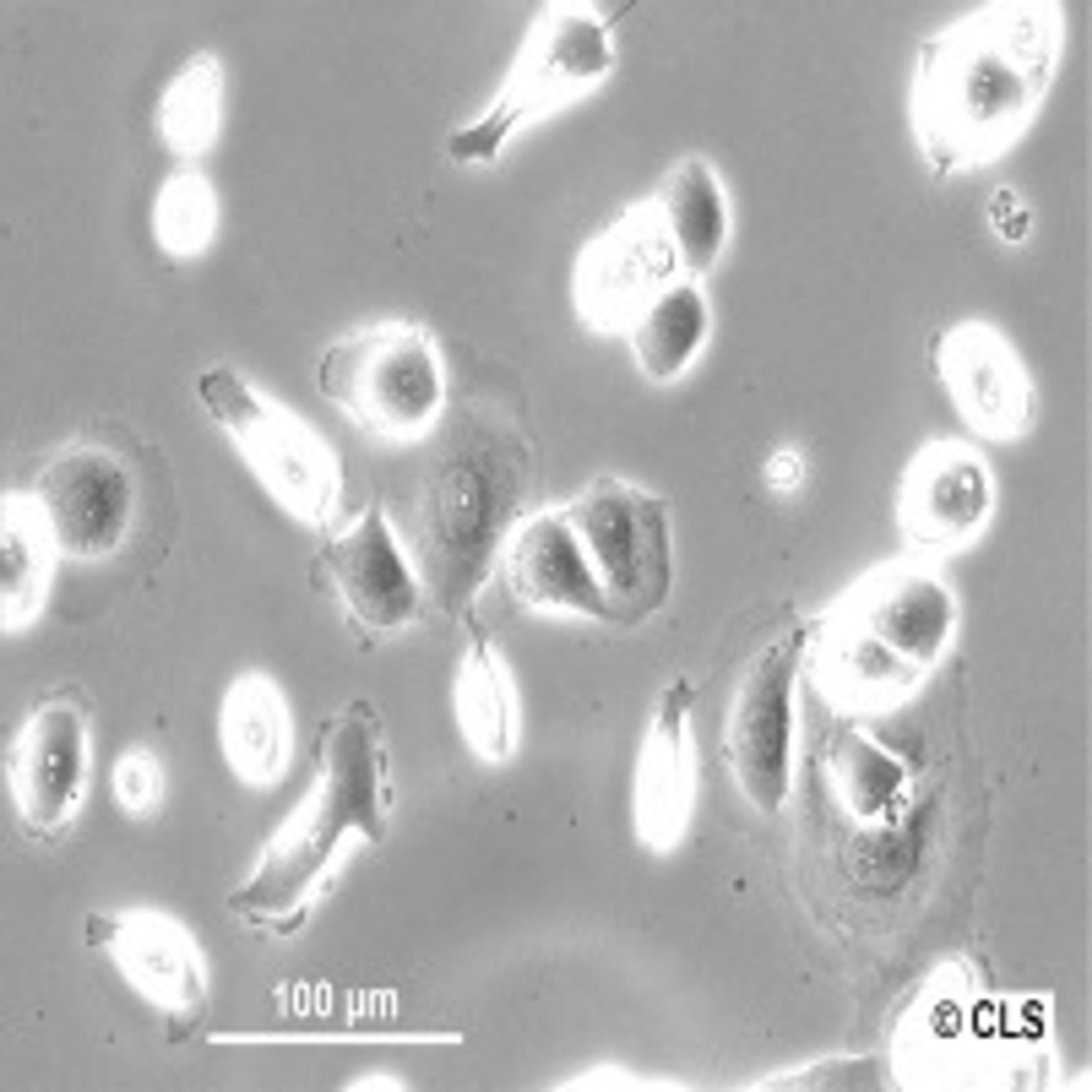 NIH:OVCAR-3 - Cell Lines Service GmbH - Life Sciences