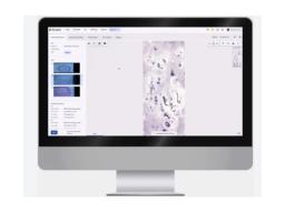 Full-Field Bone Marrow Aspirate™ (FF-BMA) Application - Scopio Labs - Clinical Diagnostics