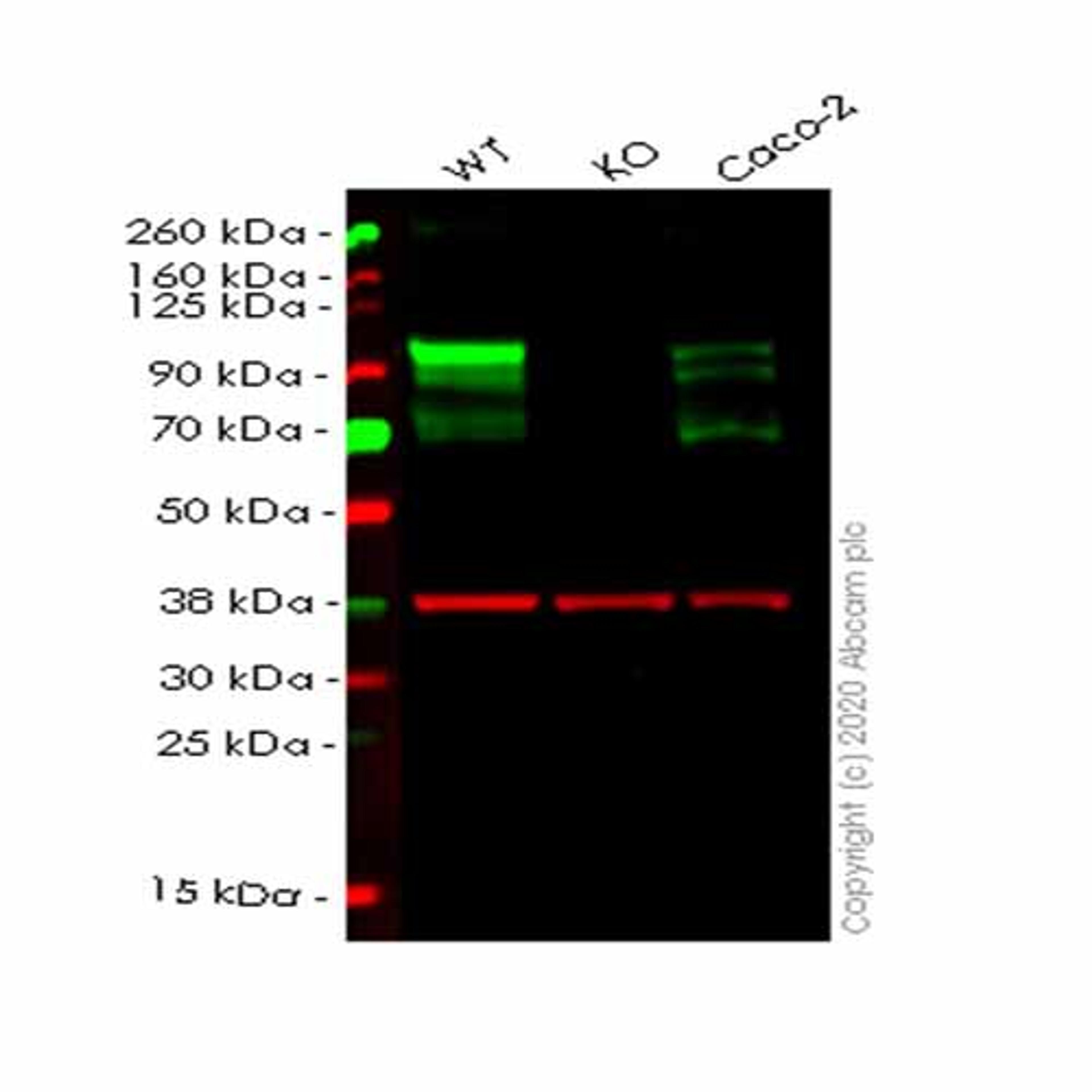 Human DAB2 knockout HeLa cell line - Abcam plc - Life Sciences