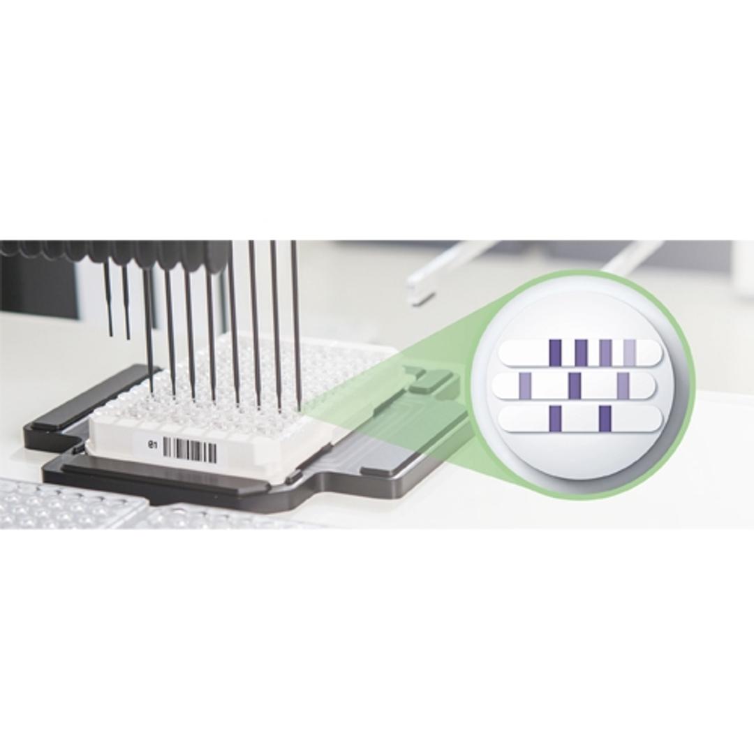 Lyme Disease Diagnostic Tests - Euroimmun - Clinical Diagnostics