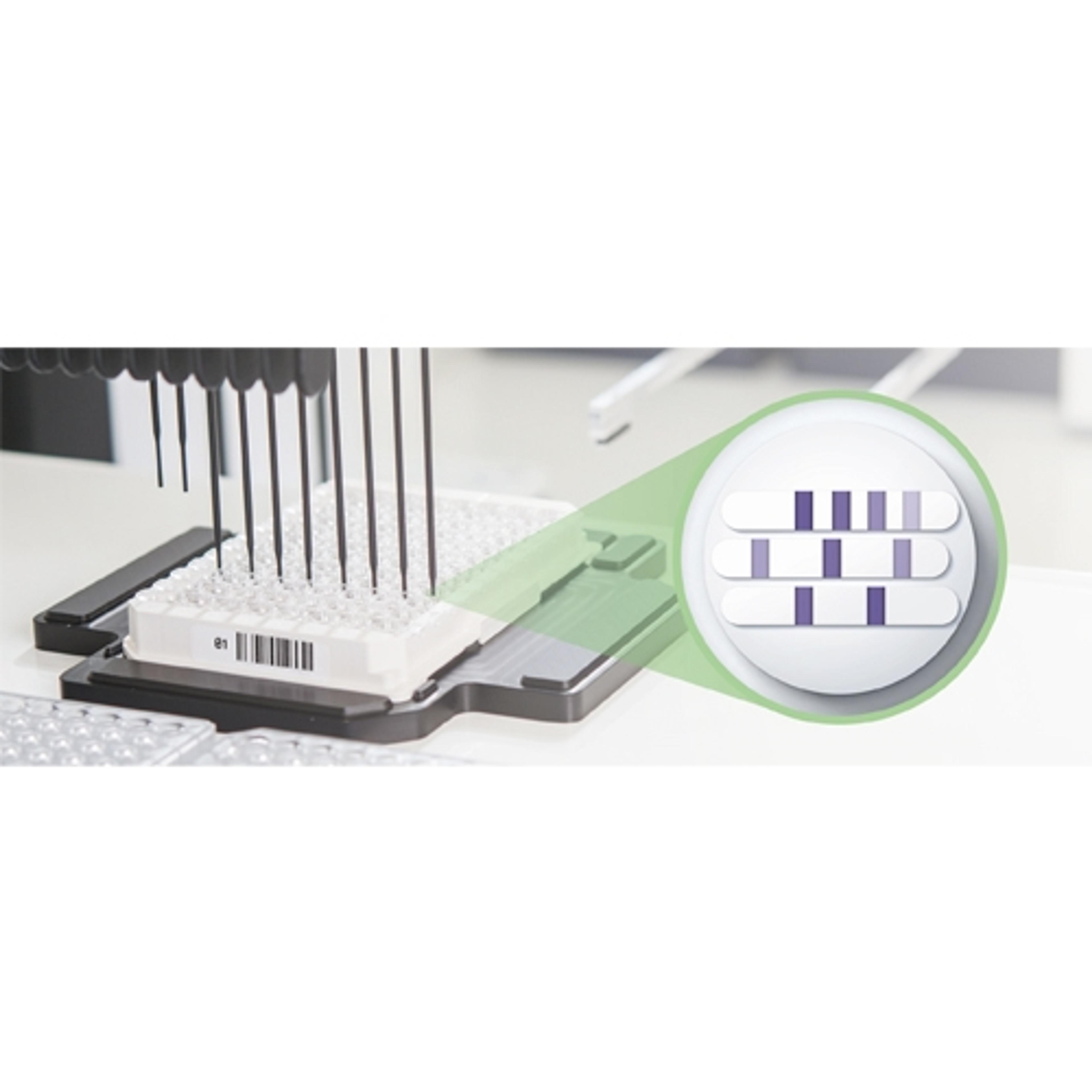 Lyme Disease Diagnostic Tests - Euroimmun - Clinical Diagnostics