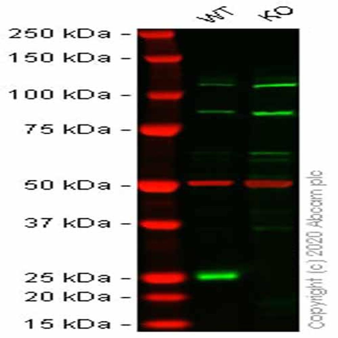 Human CBX1 (HP1 beta) knockout HEK293T cell line - Abcam plc - Life Sciences