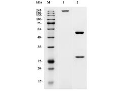 Anti-Human IL5RA Recombinant Antibody (TAB-222)