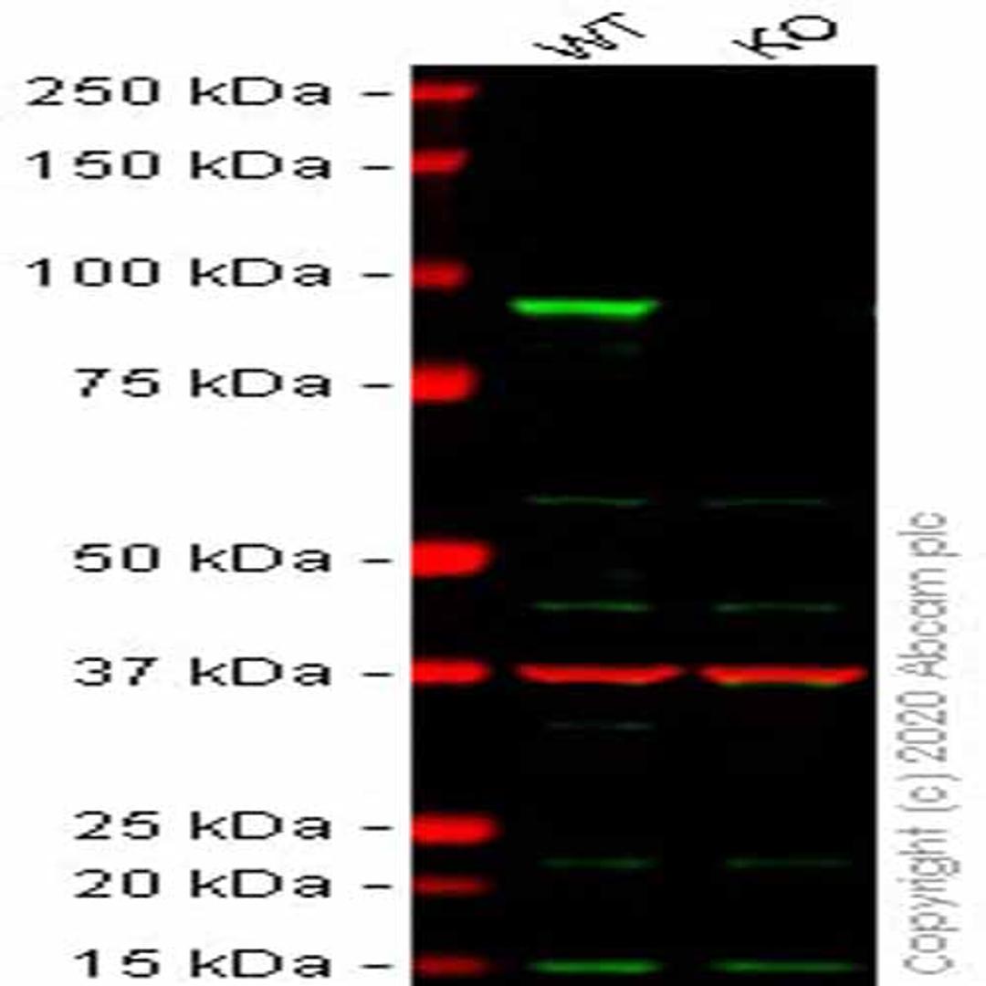Human CTNNB1 (beta Catenin II) knockout HCT116 cell line - Abcam plc - Life Sciences