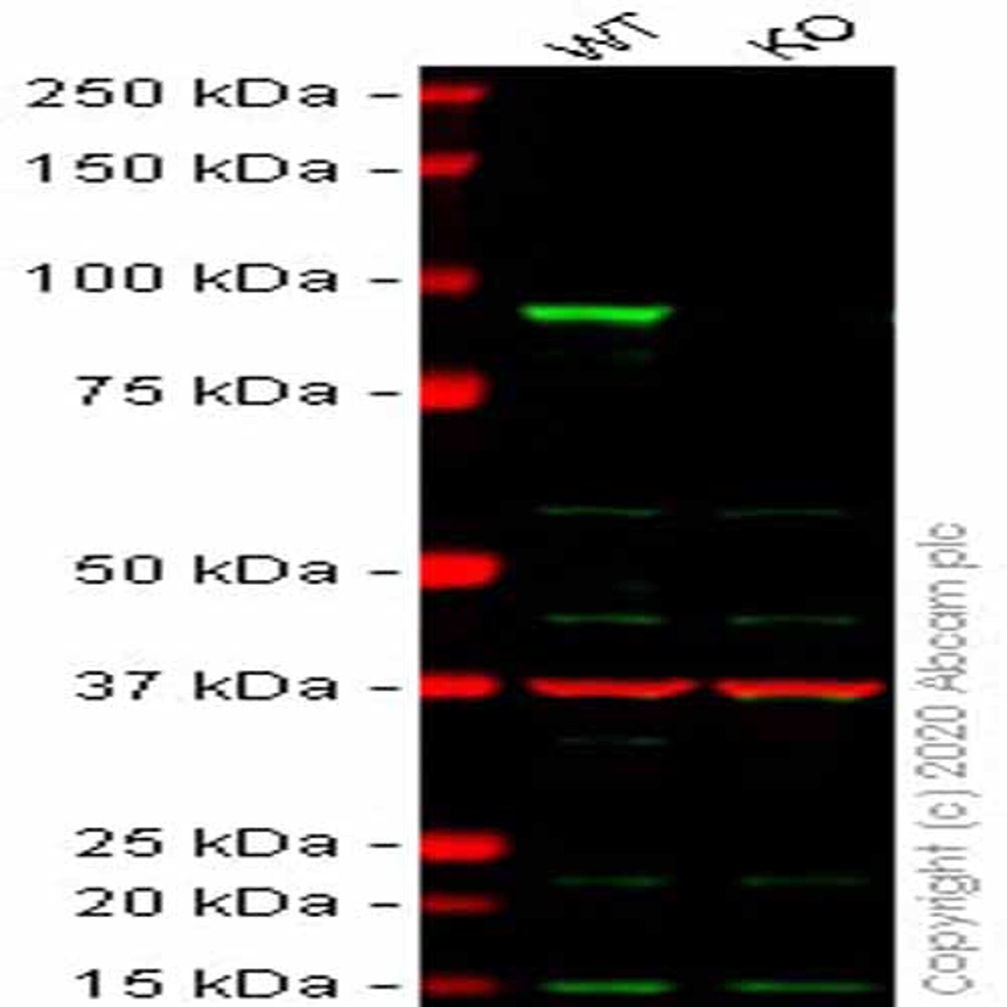 Human CTNNB1 (beta Catenin II) knockout HCT116 cell line - Abcam plc - Life Sciences