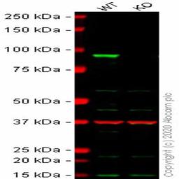 Human CTNNB1 (beta Catenin II) knockout HCT116 cell line - Abcam plc - Life Sciences