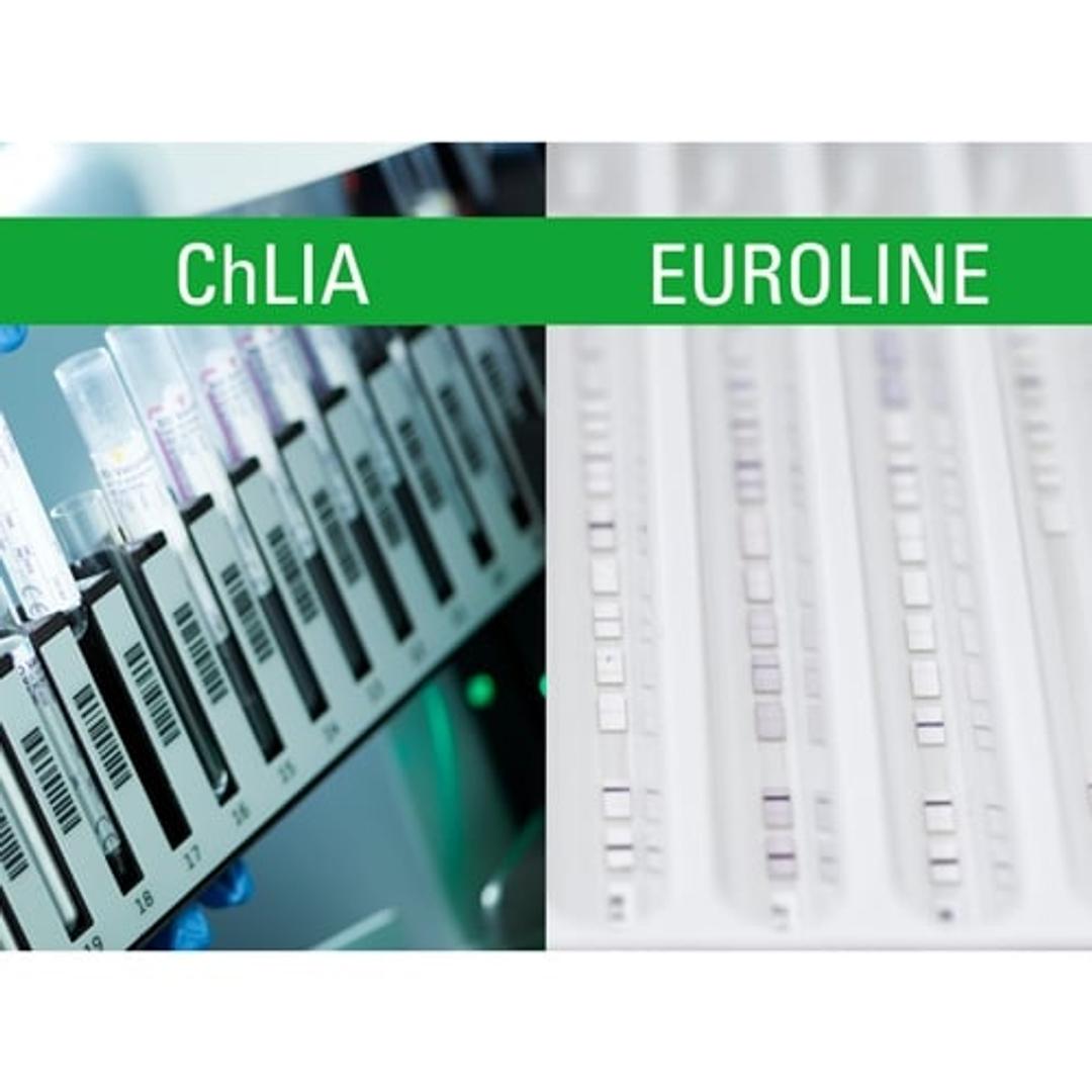 Allergy Diagnostic Tests - Euroimmun - Clinical Diagnostics