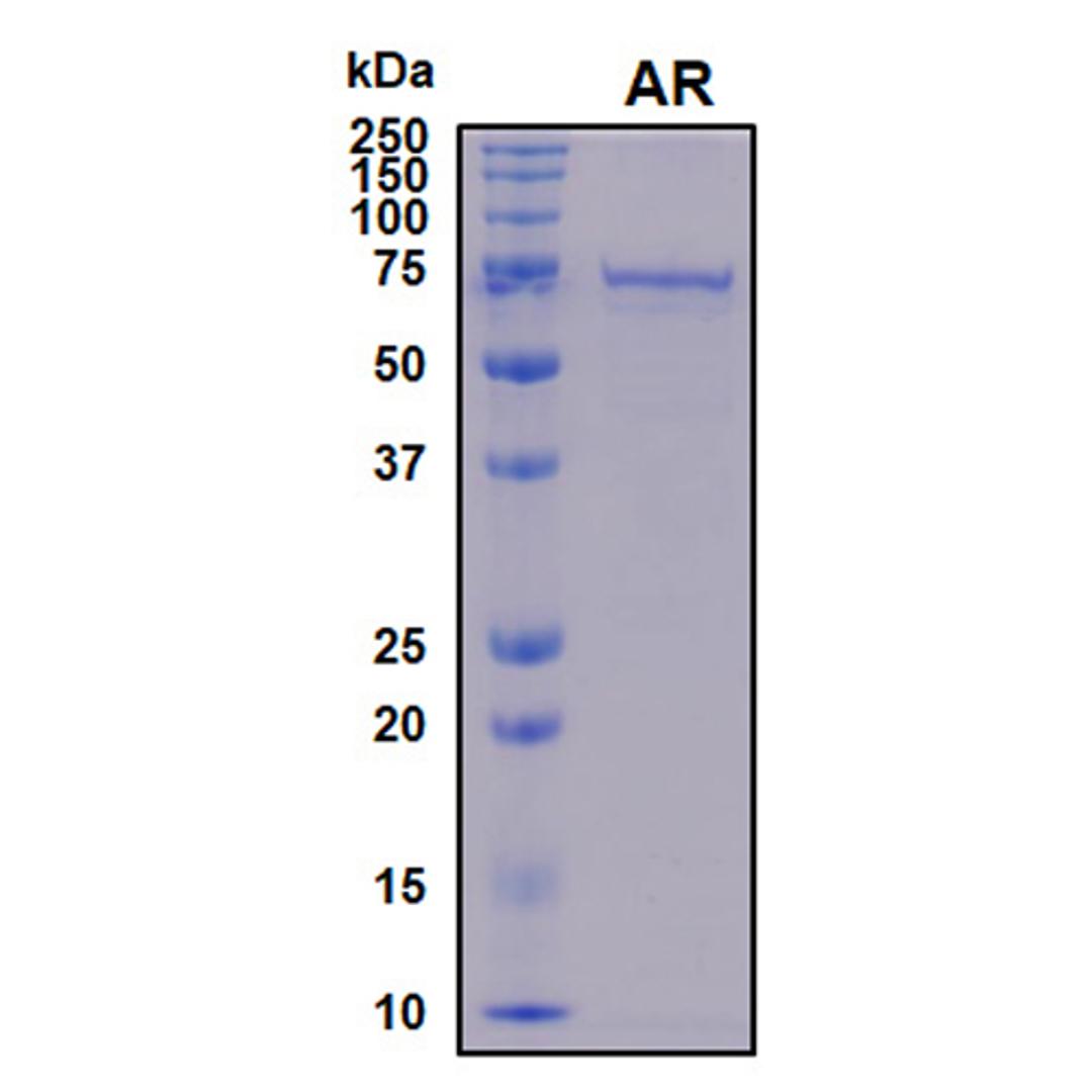 Recombinant Human Androgen Receptor - RayBiotech Inc.