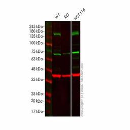 Human STAG2 (SA2) knockout HeLa cell line - Abcam plc - Life Sciences