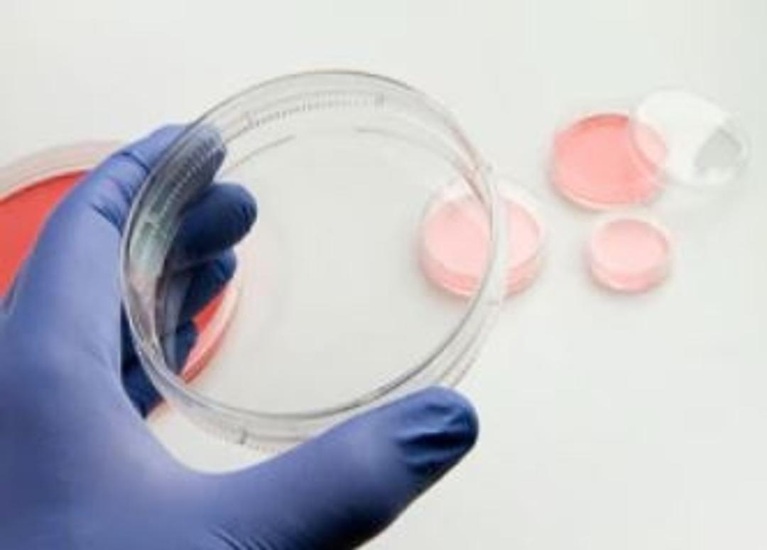 Thermo Scientific™ Nunc™ Cell Culture Dishes - Thermo Fisher Scientific - Life Sciences