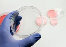 Thermo Scientific™ Nunc™ Cell Culture Dishes - Thermo Fisher Scientific - Life Sciences