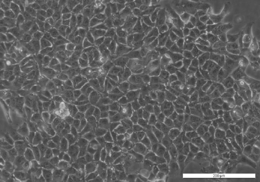 CMT 167 Cell Line - Cancer Tools - Life Sciences