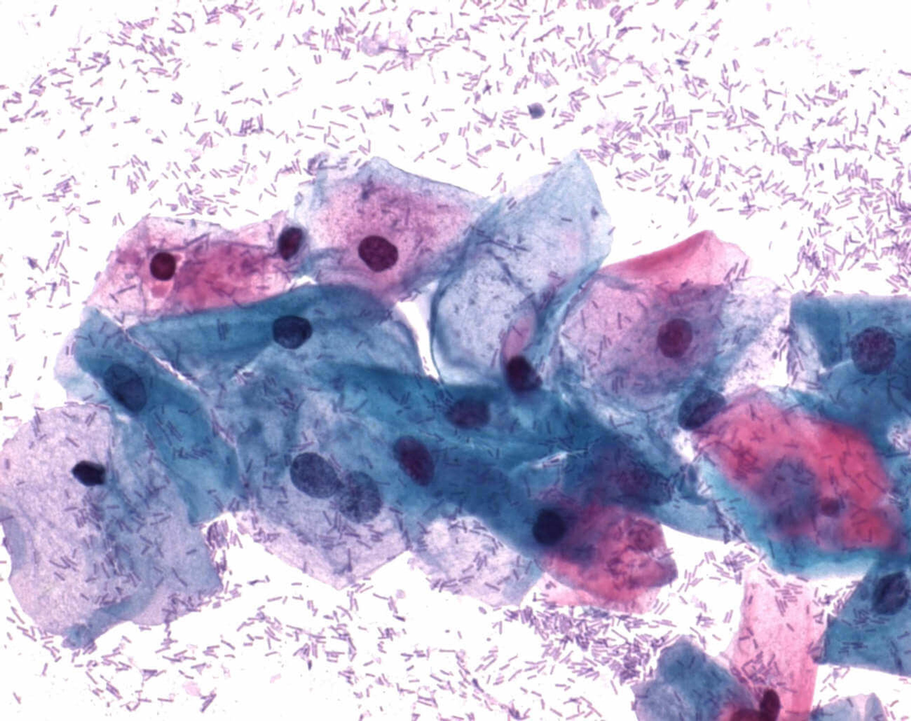 Papanicolaou's solution 3aPolychrome solution EA 31 - Merck KGaA, Darmstadt, Germany - Clinical Diagnostics