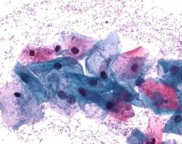 Papanicolaou's solution 3aPolychrome solution EA 31 - Merck KGaA, Darmstadt, Germany - Clinical Diagnostics