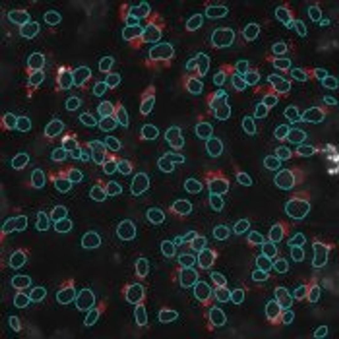 Cytotoxicity V2 Image Analysis BioApplication - null - Life Sciences