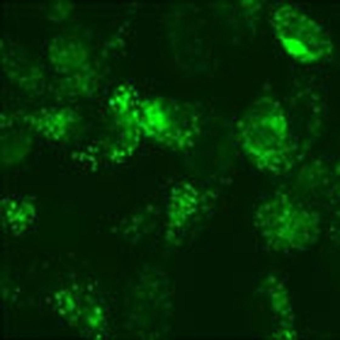Fluorescent Biosensors & Autophagy Enrichment - Merck - Life Sciences