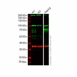 Human IFNGR1 knockout HeLa cell line - Abcam plc - Life Sciences