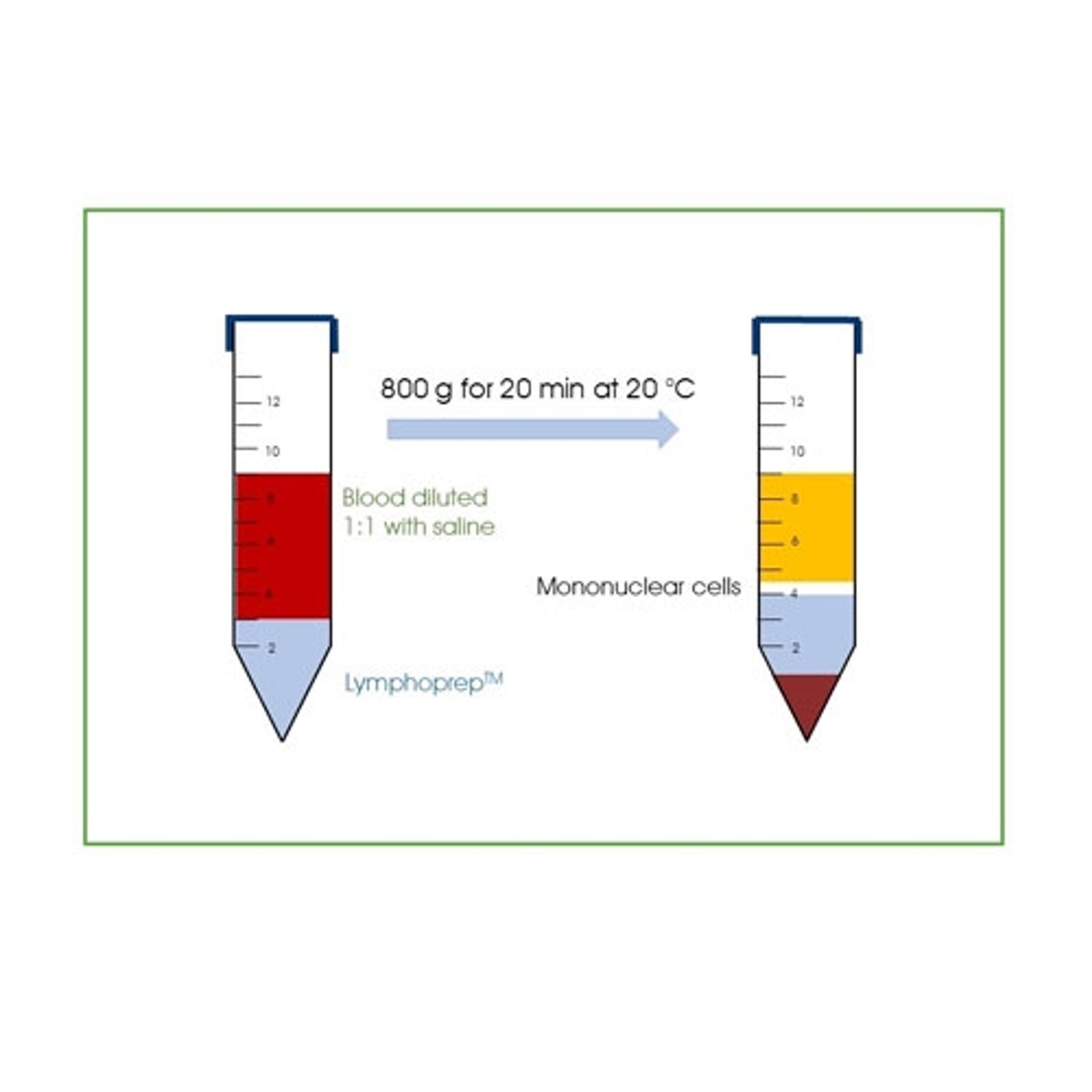 LymphoPrep™ (1x250mL) - PROGEN - General Lab
