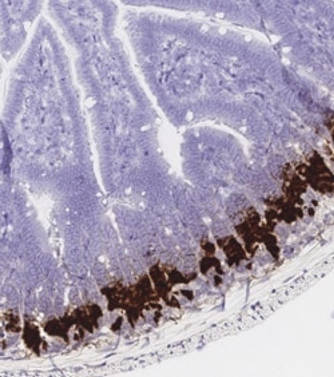RNAscope™ Chromogenic Assays - Advanced Cell Diagnostics - Life Sciences