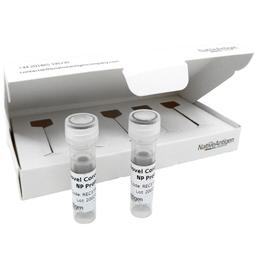 SARS-CoV-2 Nucleoprotein, His-Tag (E. coli) - The Native Antigen Company - Life Sciences