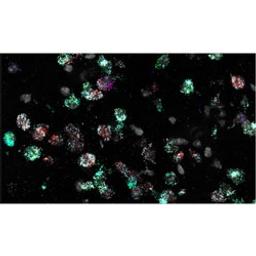 RNAscope™ HiPlex Assays - Advanced Cell Diagnostics - Life Sciences