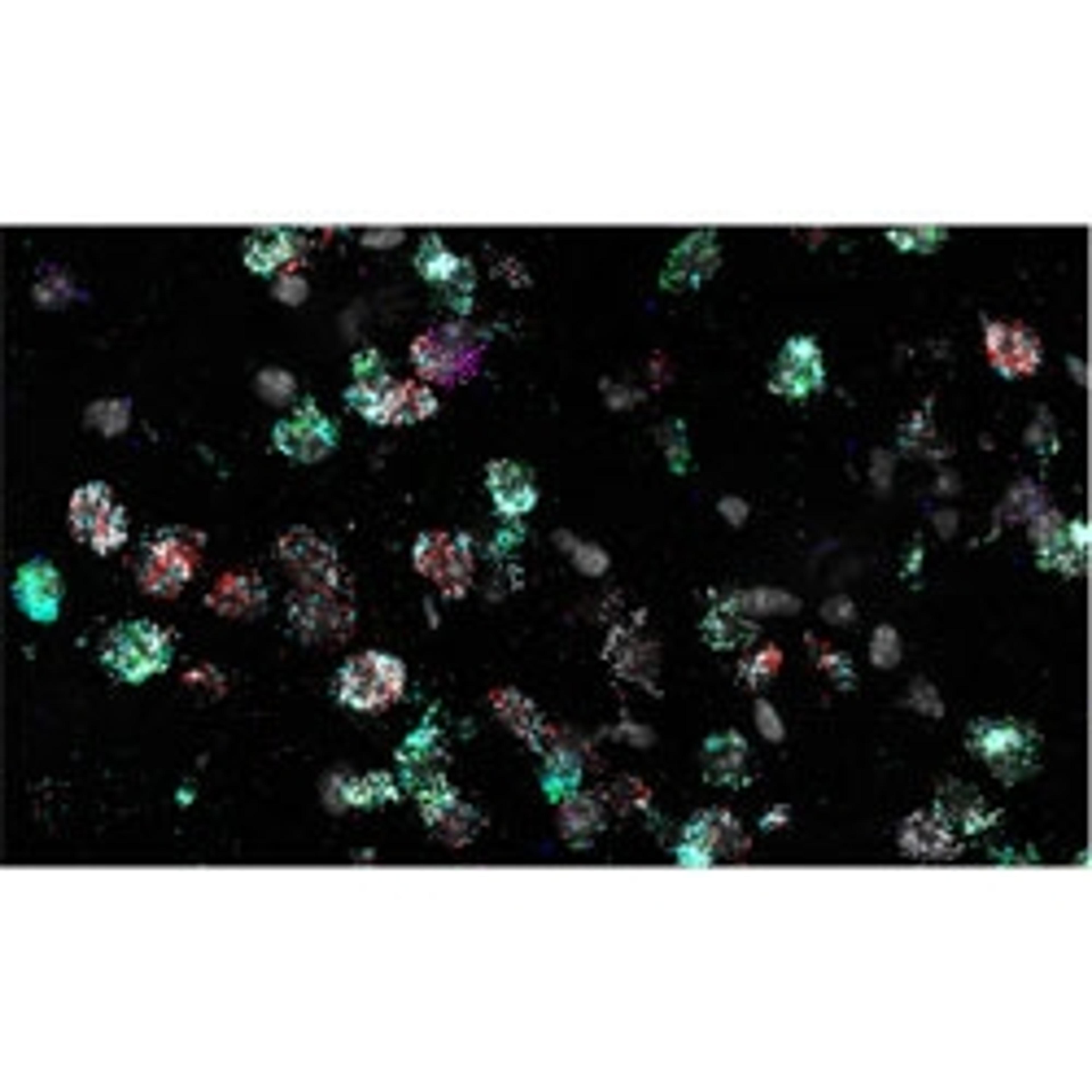 RNAscope™ HiPlex Assays - Advanced Cell Diagnostics - Life Sciences