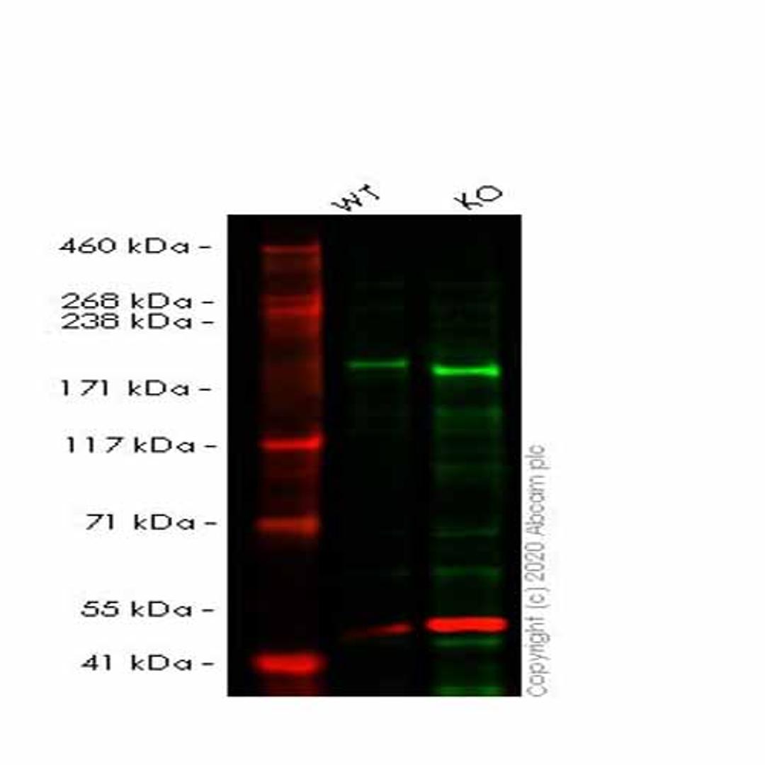 Human ATAD2 knockout HeLa cell line - Abcam plc - Life Sciences